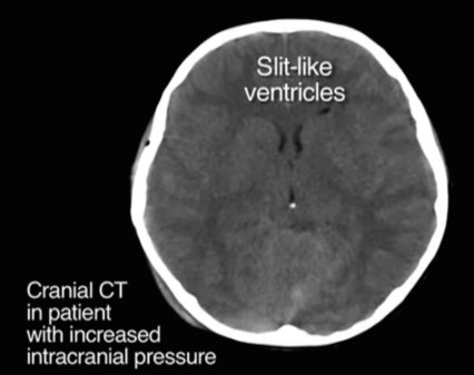 Screen Shot 2015-04-25 at 10.31.12 AM